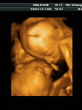 Briley Maura Horan and Gannon James Horan
